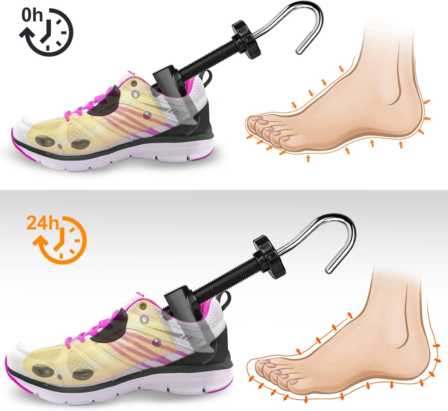 Επεκτάσιμο Φορμάρισμα Παπουτσιών